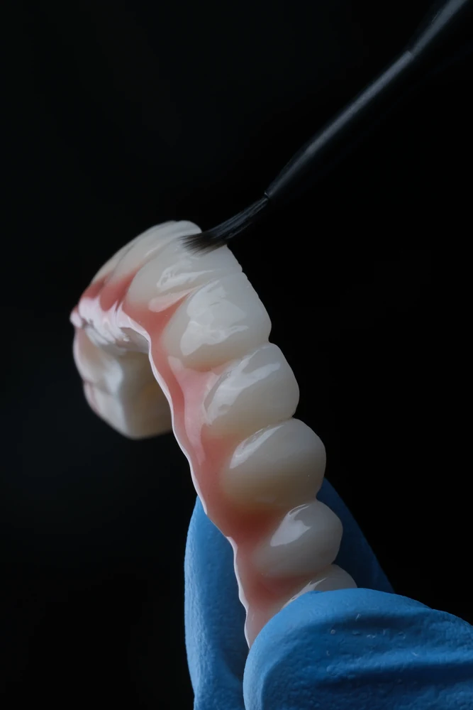 Implantatgetragener Zahnersatz aus Zirkon