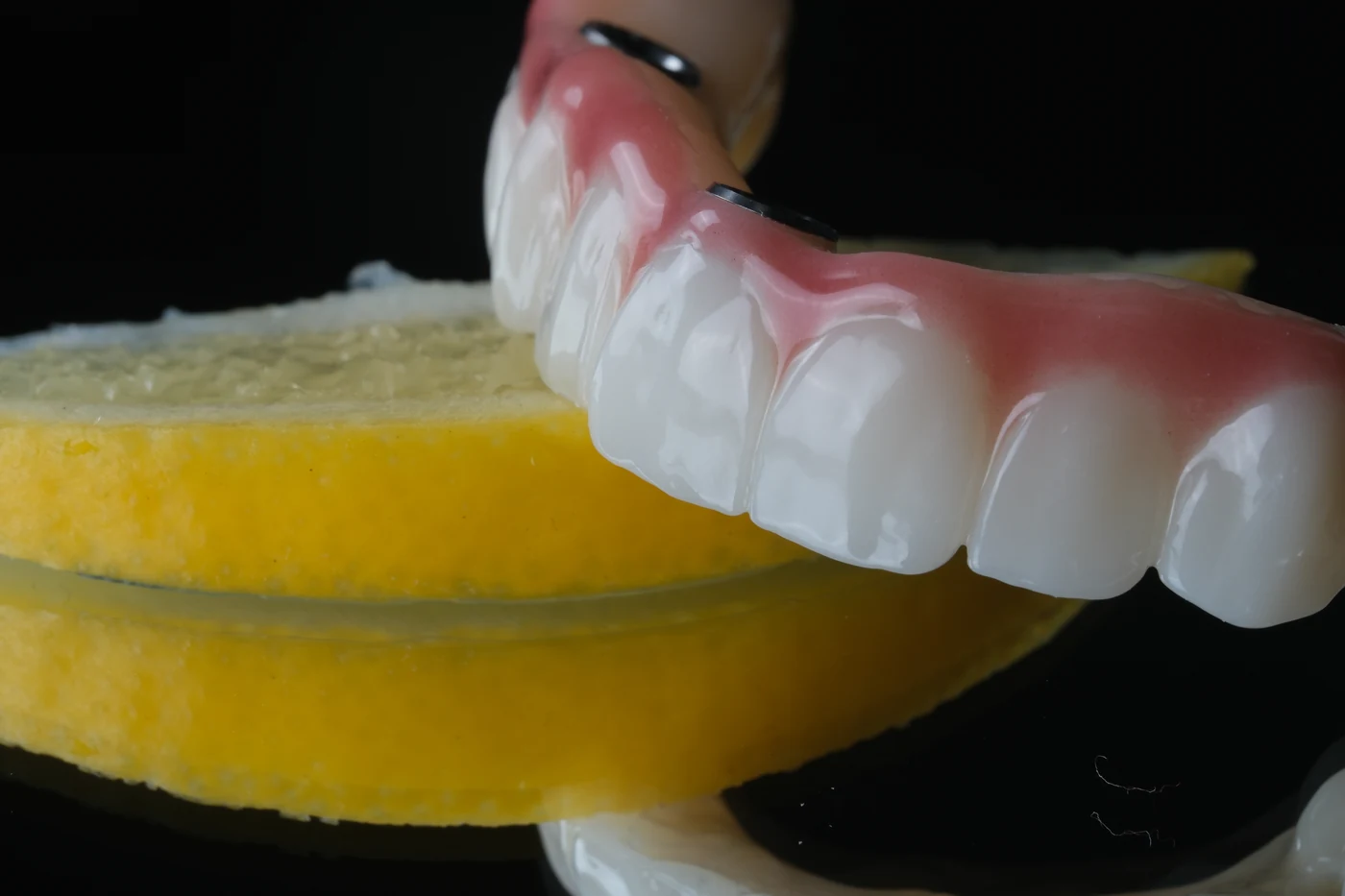 Implantatgetragener Zahnersatz aus Zirkon